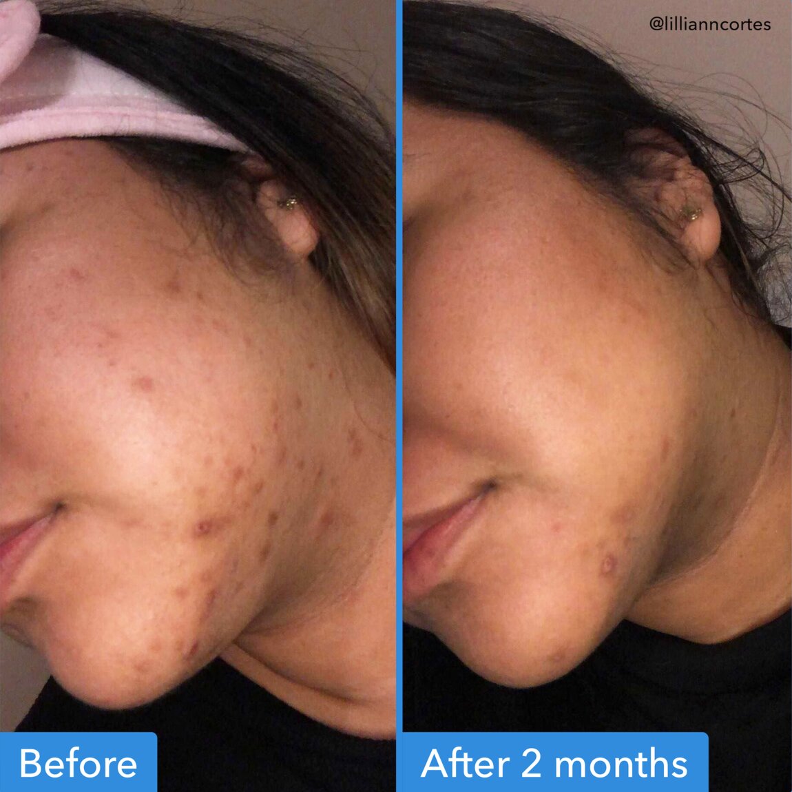 discoloration-correcting-serum-l2 zb_p.jpg