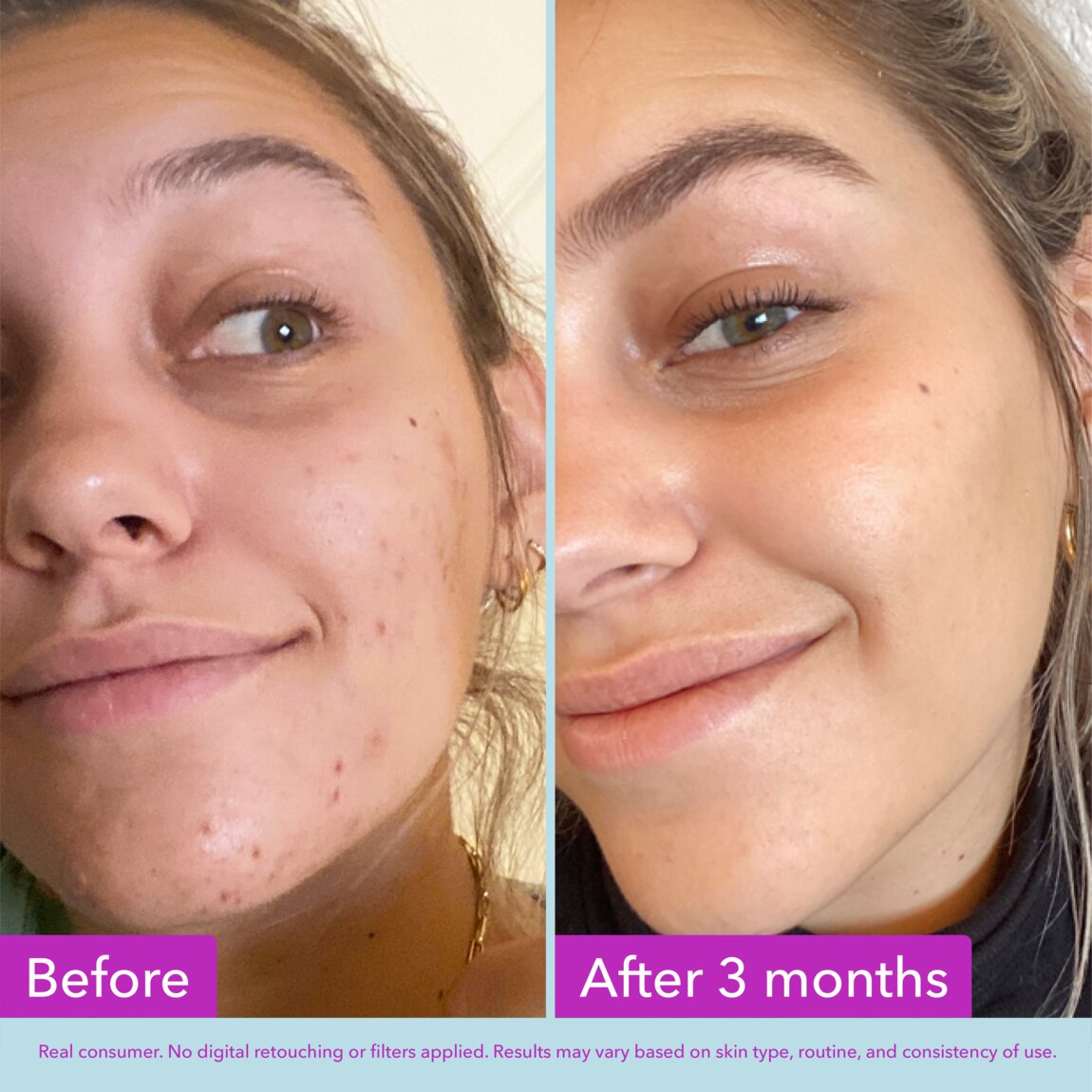 niacinamide-brightening-toner-a6 zb_p.jpg