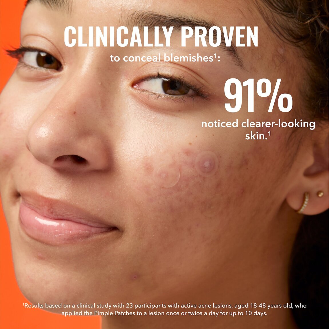 pimple-patches-q3 zb_p.jpg
