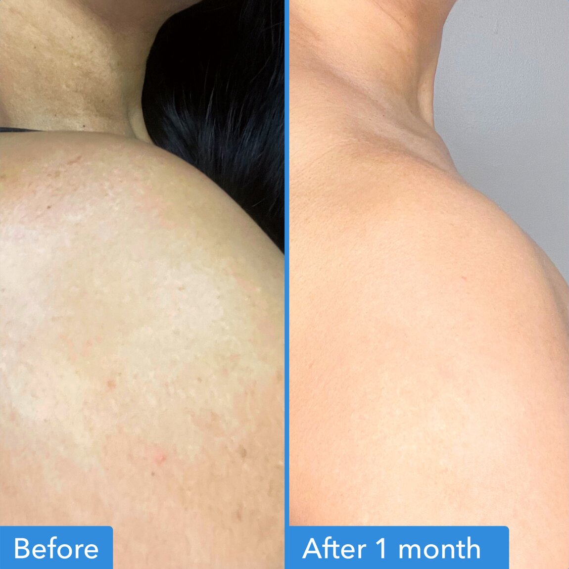discoloration-correcting-body-treatment-d3 zb_p.jpg